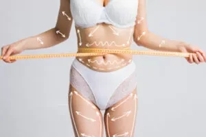 Aculaser Body Contouring