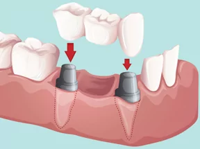 Riverbend Dental Clinic