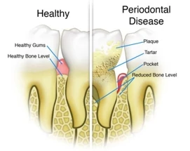 Exceptional Dental/UPTOWN