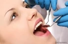 General Dental Exam & Evaluation